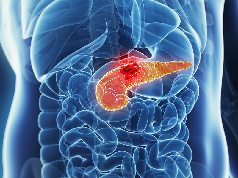 dailymagnesiumintakecanpreventpancreaticcancer